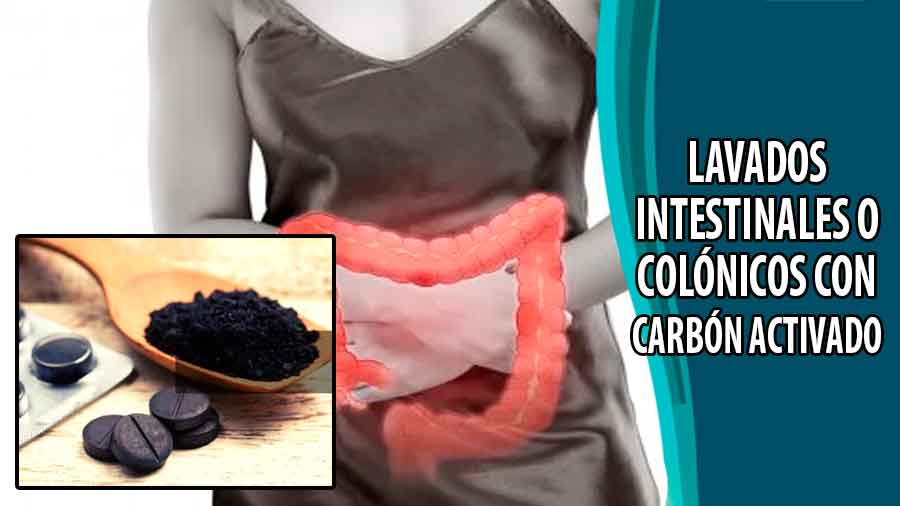 Lavados intestinales o colÃ³nicos con carbÃ³n activado